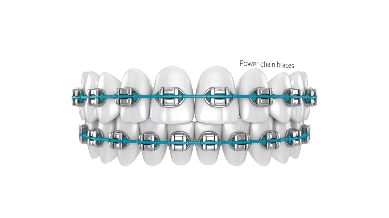 PlastCare USA Dental Orthodontic Power Chains – 15 Feet Long – Short/Closed/Multiple Colors